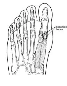 Sesamoid